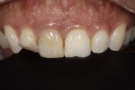 Before - Figges Marsh Dental